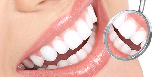 Restaurações Estéticas