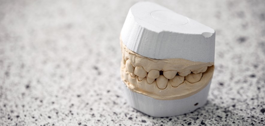 Qual a importância que você dá aos modelos de gesso?
