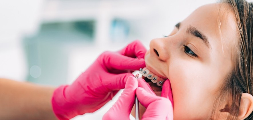 Qual broca é ideal para remover resina do aparelho ortodôntico?