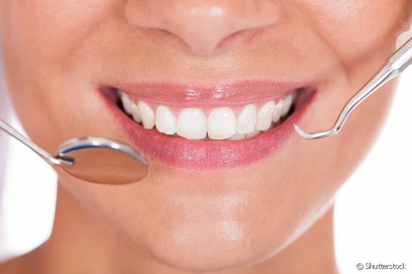 Lente de Contato Dental