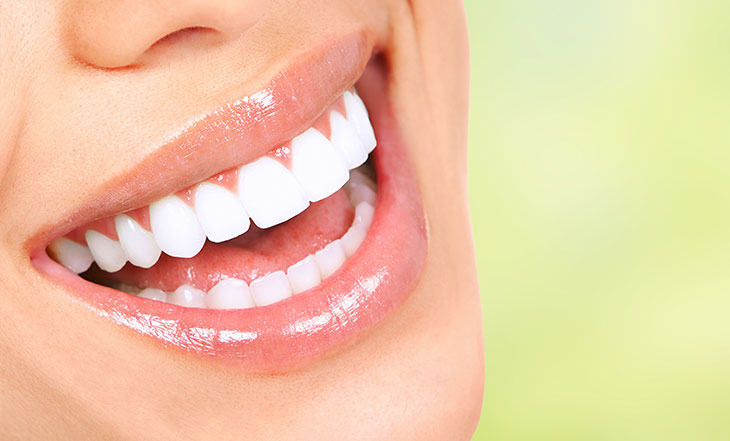 Clareamento Dental